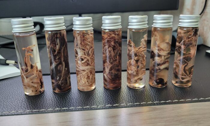 Embalmers have been observing large, and very long, clots inside the corpses they treat.