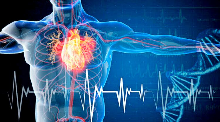 2022 Excess Deaths All Around the World Raise an Alarm